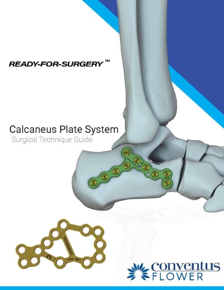 Resources Conventus Flower Orthopedics