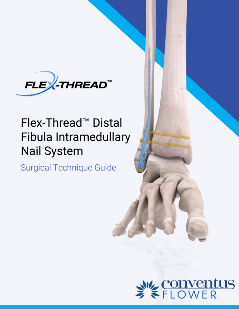 Resources Conventus Flower Orthopedics