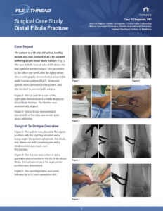 Dr. Cary Chapman Flex-Thread Distal Fibula case study