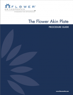 akin_plate_guide